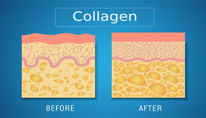 Collagen giúp nâng đỡ mô da