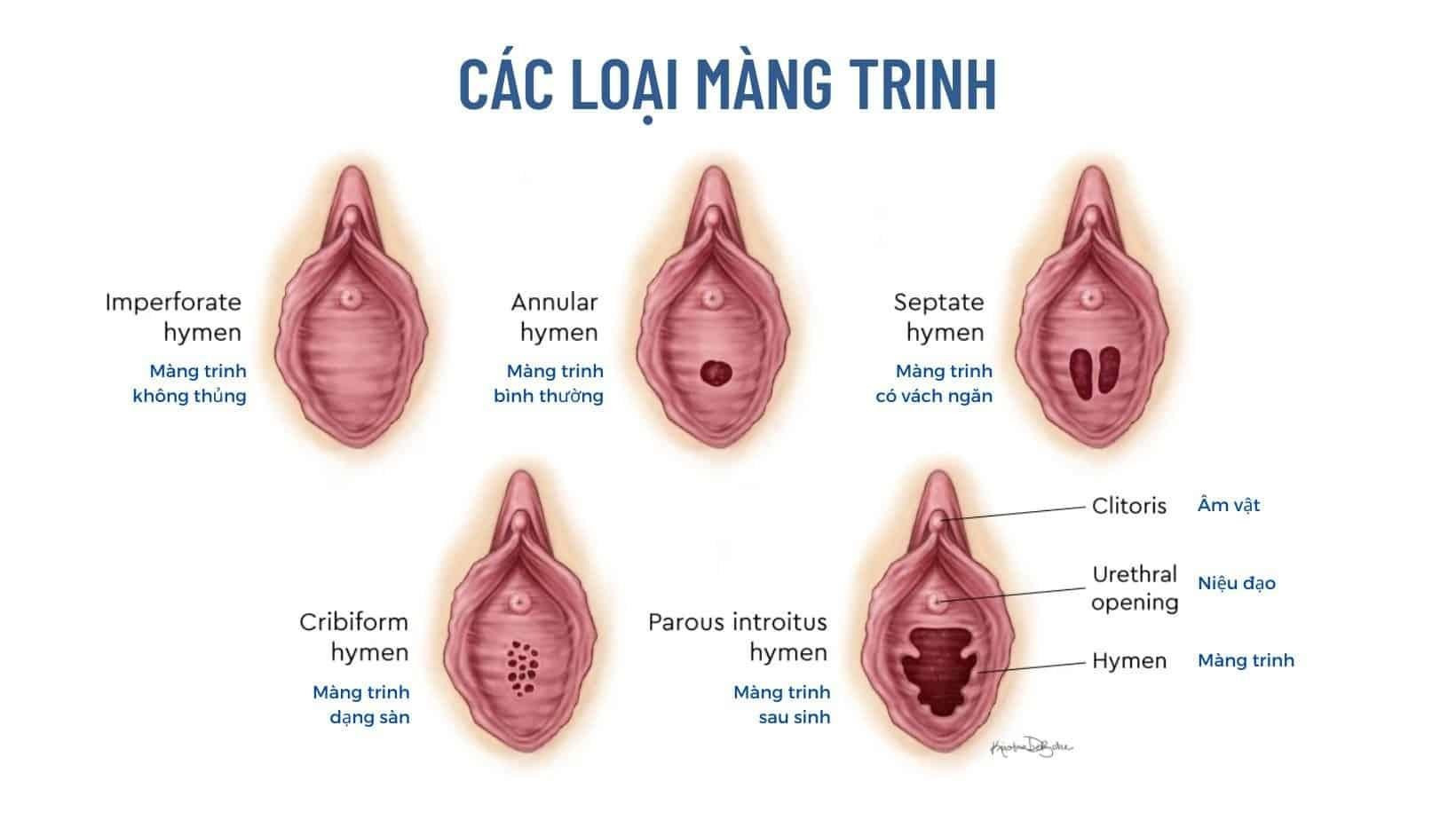 Cấu tạo Màng trinh trong bộ phận sinh dục nữ