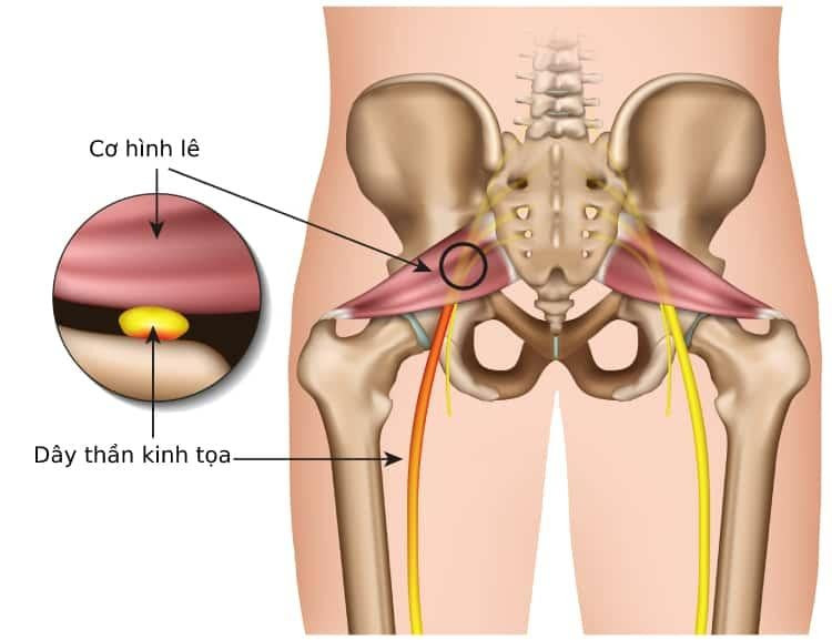 8 Nguyên Nhân Gây Đau Lưng Ở Phụ Nữ Và Cách Chăm Sóc Sức Khỏe