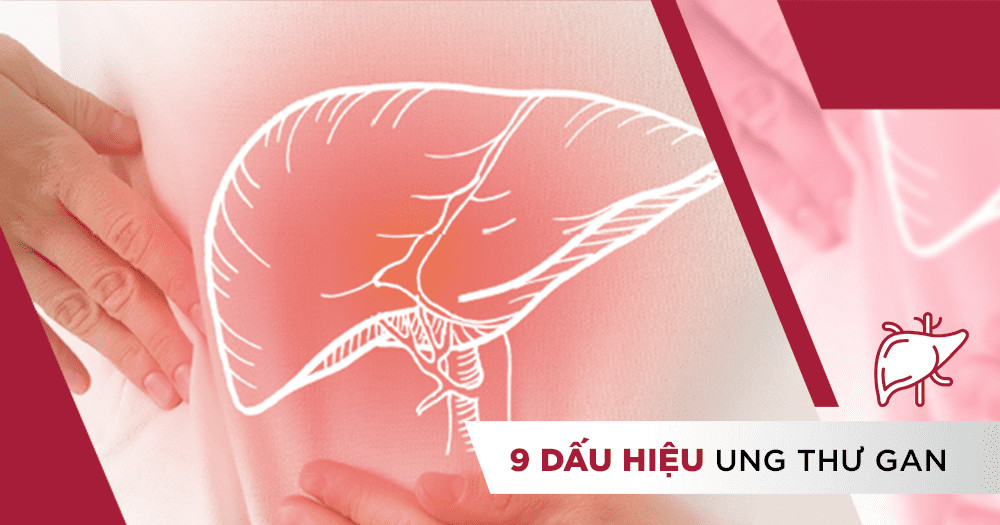 9 dấu hiệu ung thư gan giúp bạn phát hiện bệnh sớm