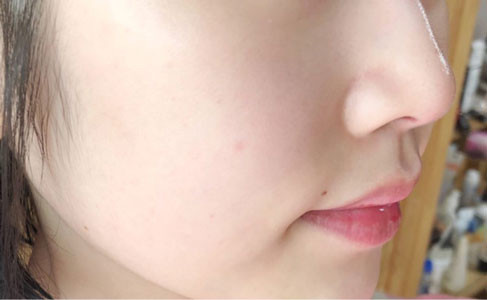 Bổ sung collagen giúp da khỏe đẹp