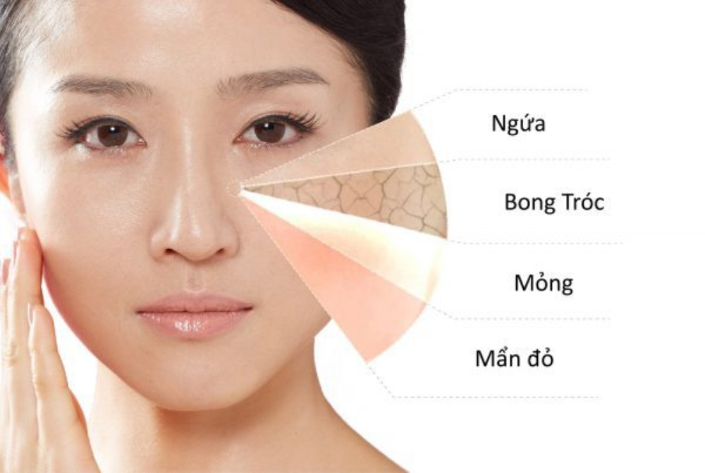 Cách Chăm Sóc Da Mặt Mùa Hanh Khô Nâng Cao Sức Khỏe Làn Da