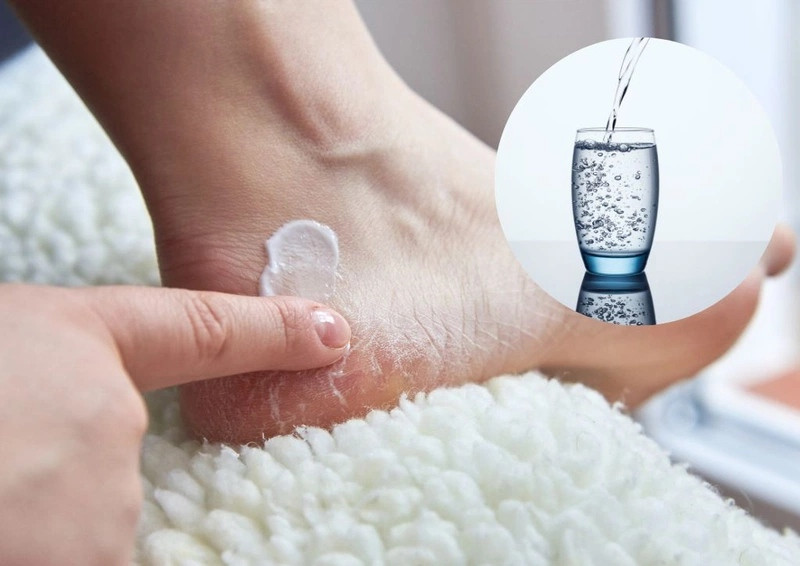 Cách dưỡng ẩm cho da chân hiệu quả