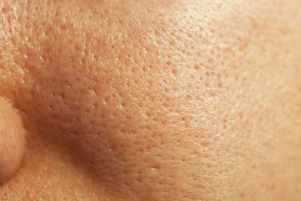 Cách Se Khít Lỗ Chân Lông Hiệu Quả