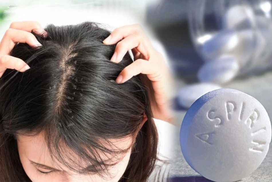 Cách trị hết gàu với Aspirin