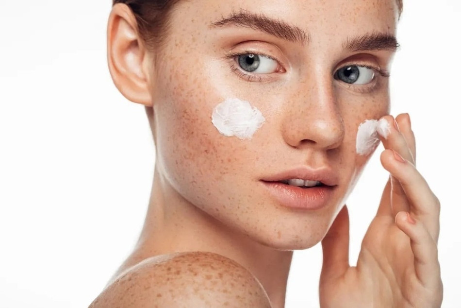 Cải thiện nám chân đinh bằng kem trị nám