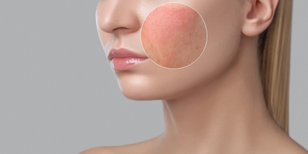 Chăm sóc da không cần mỹ phẩm giúp hạn chế kích ứng và đảm bảo an toàn