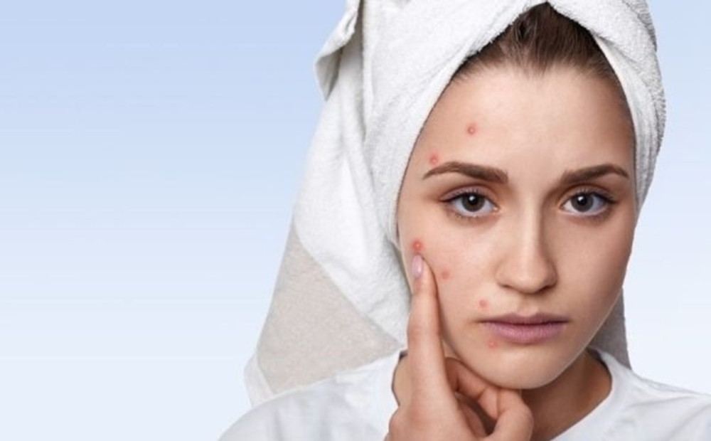 Chăm sóc da mùa đông bằng cách tăng cường độ ẩm cho da