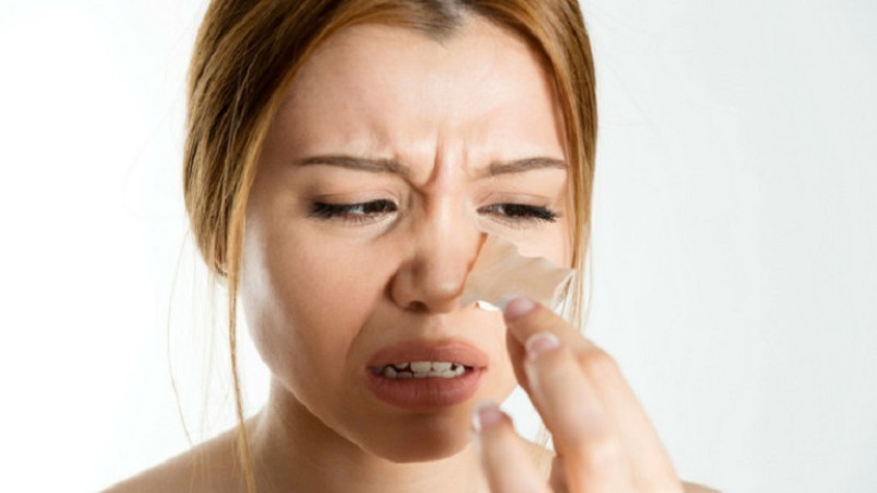 Chăm sóc da sai cách khiến da khô và nổi mụn