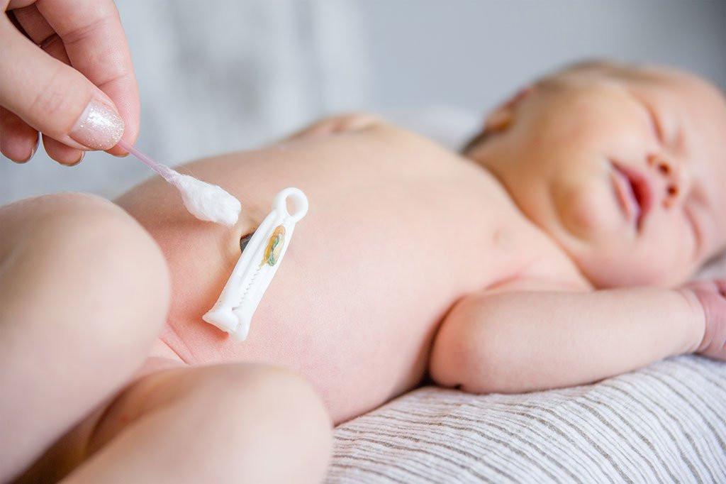 Chăm sóc rốn cho bé sau sinh đúng cách