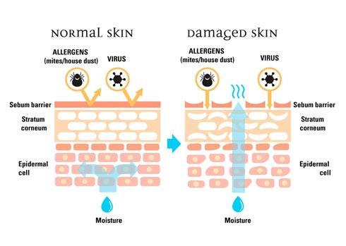 Niacinamide là gì? 4 công dụng của Niacinamde trong làm đẹp