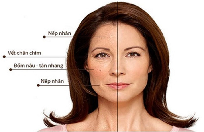 Da mặt độ tuổi tiền mãn kinh xuất hiện thêm nhiều khuyết điểm hơn