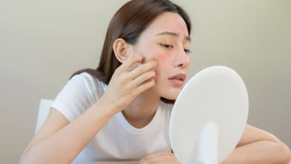 Top 13 Kem Chống Nắng Dành Cho Da Nhạy Cảm An Toàn và Hiệu Quả