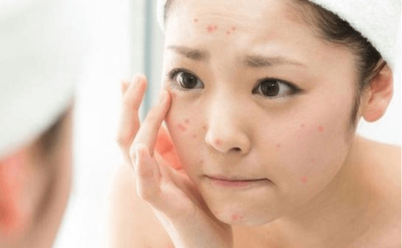 Da nhạy cảm có thể thay đổi tùy thuộc vào cơ địa của mỗi người và nguyên nhân gây ra.