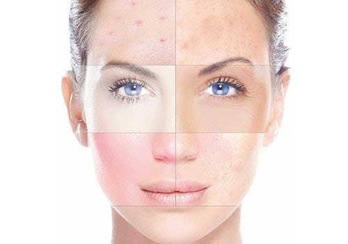 Đặc điểm da hỗn hợp