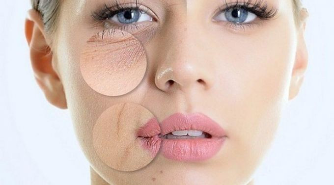 Dấu hiệu nhận biết lão hóa da