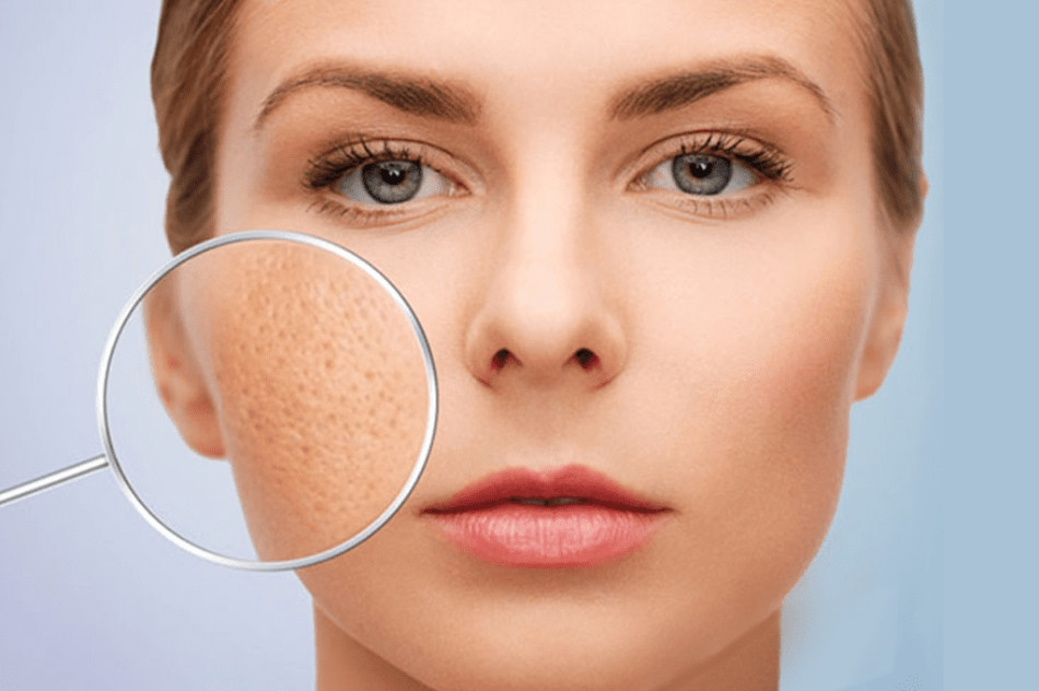 Dùng sai sữa rửa mặt có thể phá hủy lớp bảo vệ tự nhiên của da
