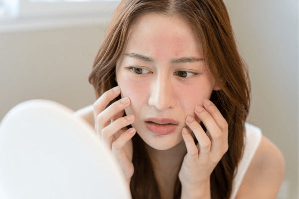 Dưỡng ẩm đúng cách cho da nhạy cảm