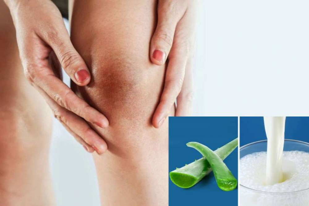 Dưỡng trắng đầu gối với nha đam và sữa tươi
