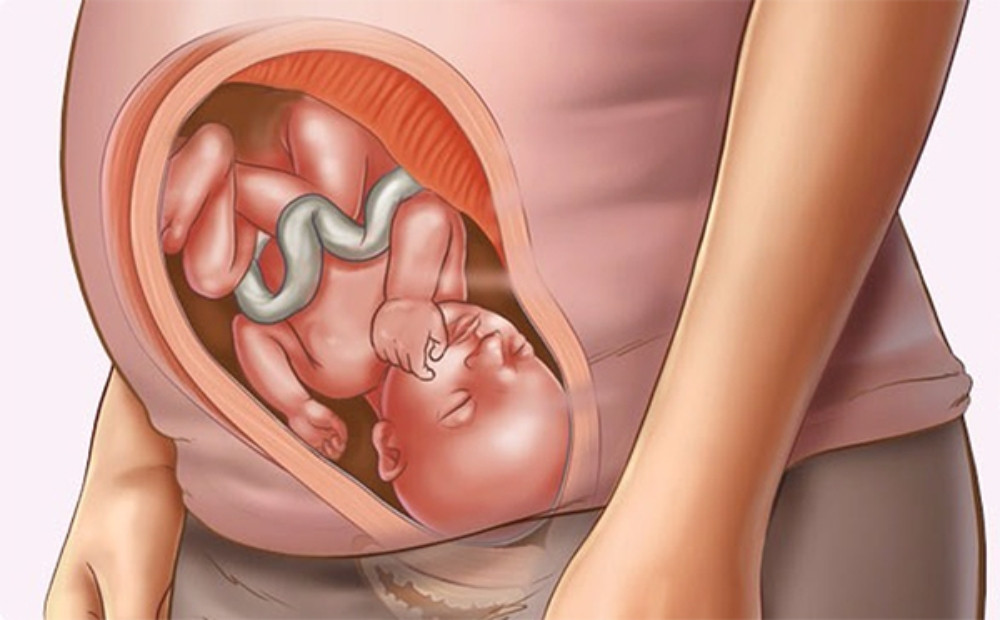 Gạo lứt đen ngăn ngừa dị tật bẩm sinh