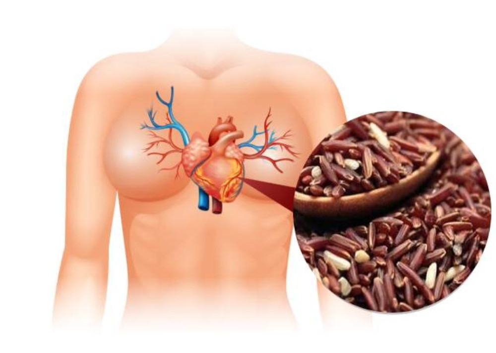 Gạo Lứt Giúp Giảm Đột Quỵ Và Xơ Vữa Động Mạch