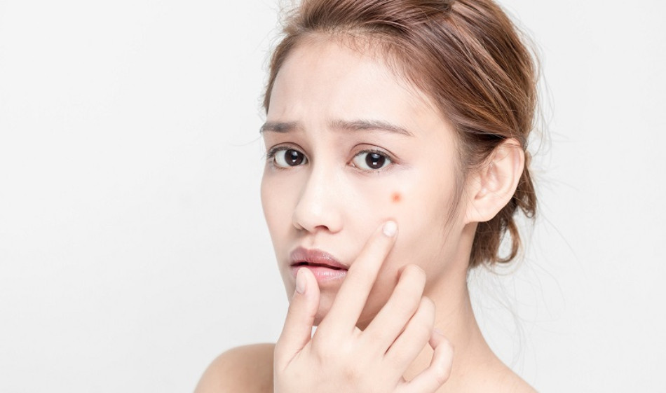 Gạo lứt giúp giảm mụn hiệu quả