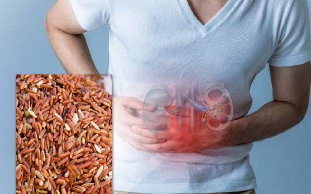 Gạo Lứt Giúp Giảm Nguy Cơ Sỏi Thận