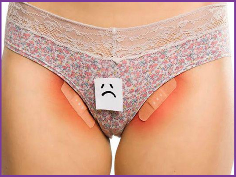 Gây kích ứng da khi mặc quần lọt khe