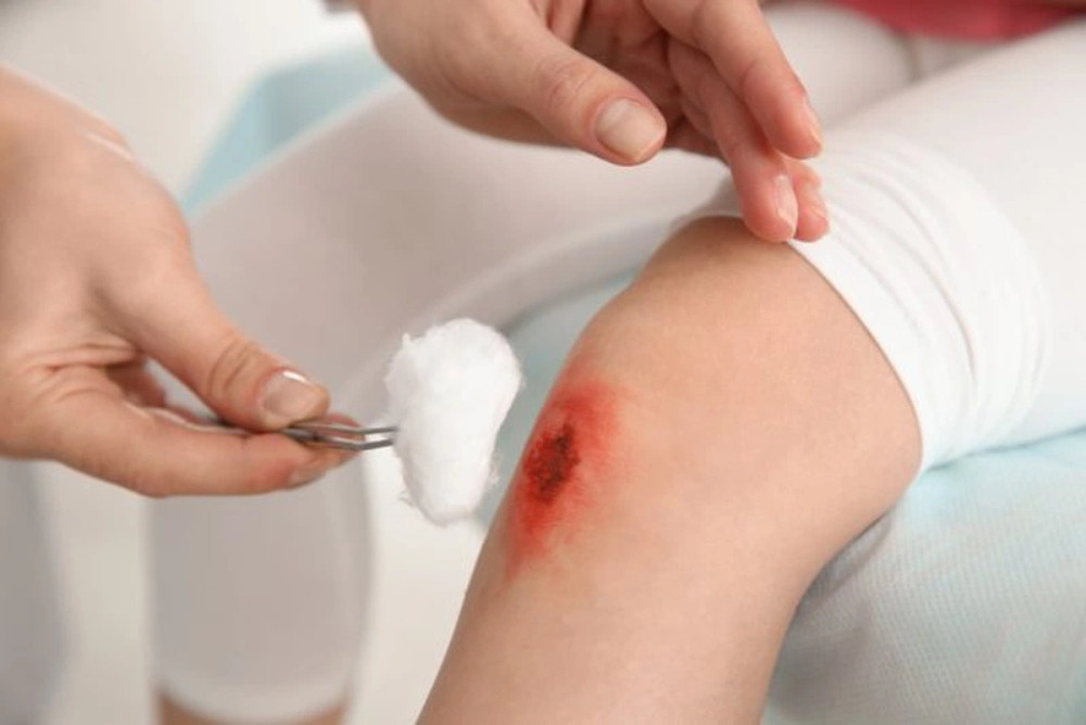Giai đoạn tăng sinh giúp vết thương lành lại