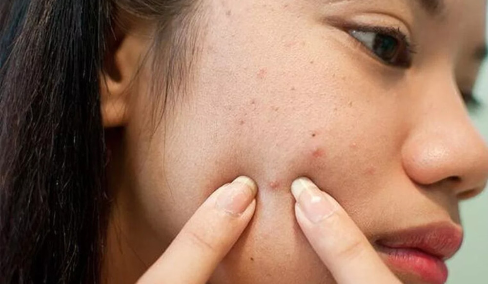 Hạn chế sờ tay lên mặt