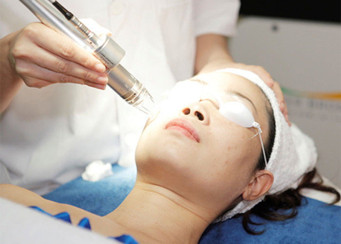 Hình ảnh minh họa quy trình tái tạo da bằng laser