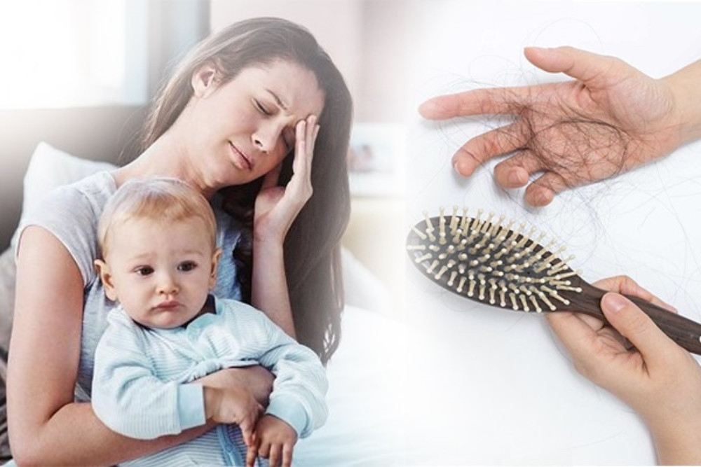 Hướng dẫn cách chăm sóc mái tóc sau sinh đơn giản tại nhà