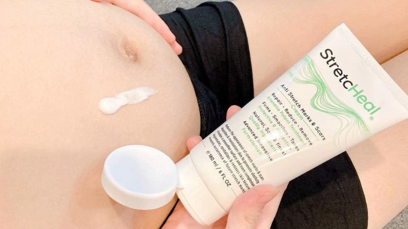 Review 18+ kem trị rạn da cho bà bầu tốt nhất được chuyên gia khuyên dùng