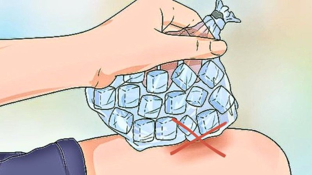 Không chườm túi đá lạnh ngột lên vùng da bị cháy nắng