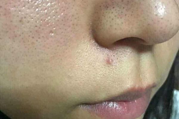 Khu vực nhiều dầu