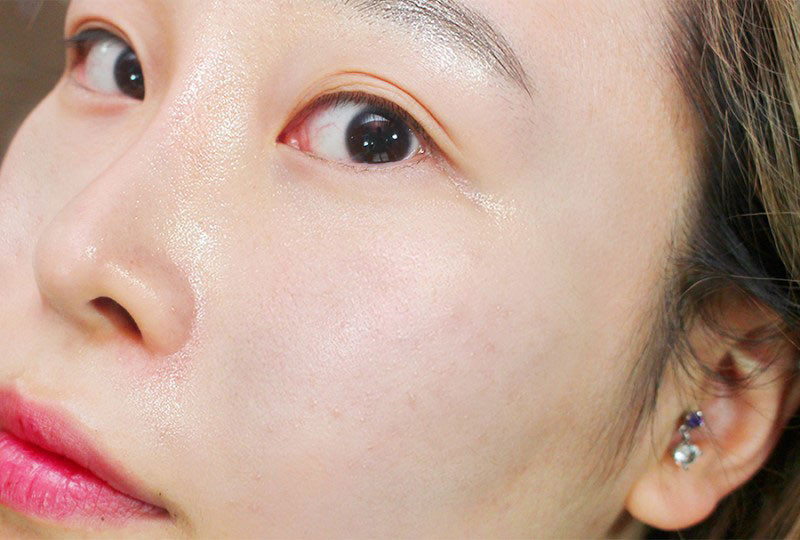 làm sao để nhận biết da hỗn hợp