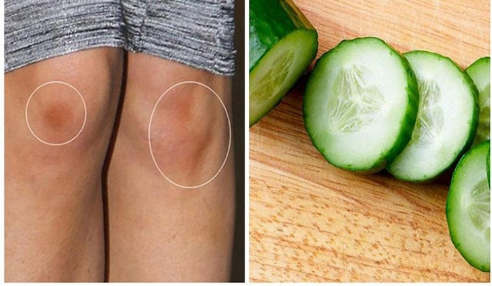 Làm trắng đầu gối với dưa chuột