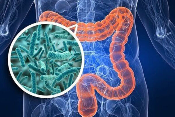 Lợi khuẩn hỗ trợ giảm cân