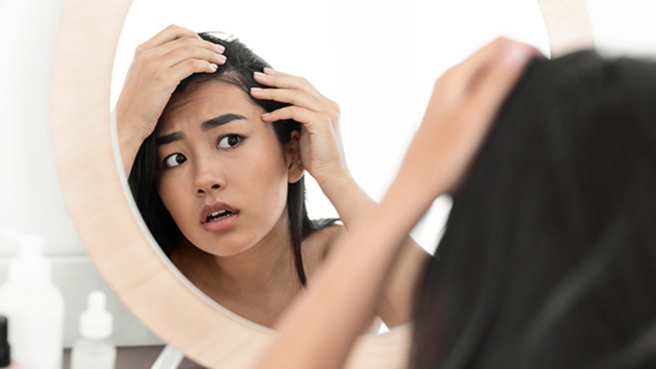 Mất Cân Bằng Nội Tiết Tố Gây Ra Nhiều Vấn Đề Cho Tóc