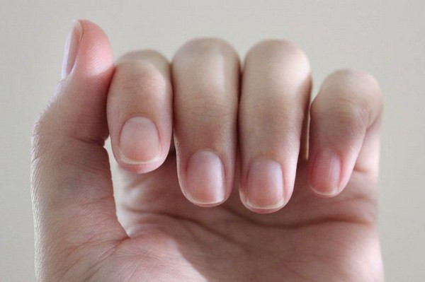 10 Điều Cần Tránh Khi Bị Mụn Để Bảo Vệ Làn Da Khỏe Mạnh