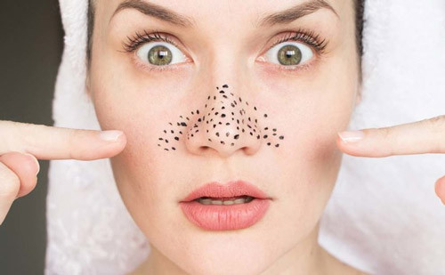 12 cách loại bỏ mụn đầu đen hiệu quả