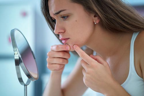 Mụn trứng cá hình thành do nhiều nguyên nhân