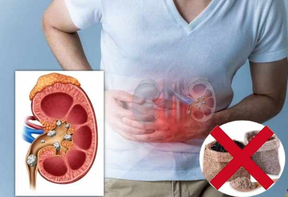 Người bị sỏi thận không nên sử dụng bột gạo lứt mè đen