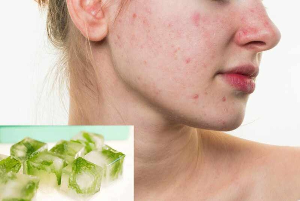 Cách Làm Đẹp Bằng Nha Đam Đông Đá Hiệu Quả Tại Nhà