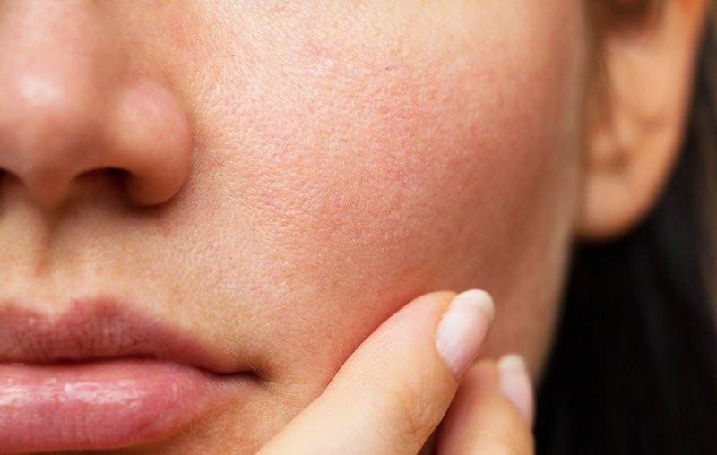 Những lưu ý cơ bản khi chăm sóc da khô