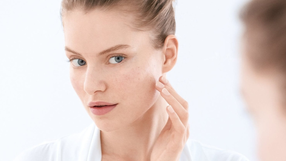 Những lưu ý khi chăm sóc da mặt bị mụn ẩn