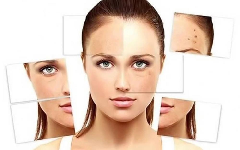 Những vấn đề mà da thường gặp phải trong mùa hè