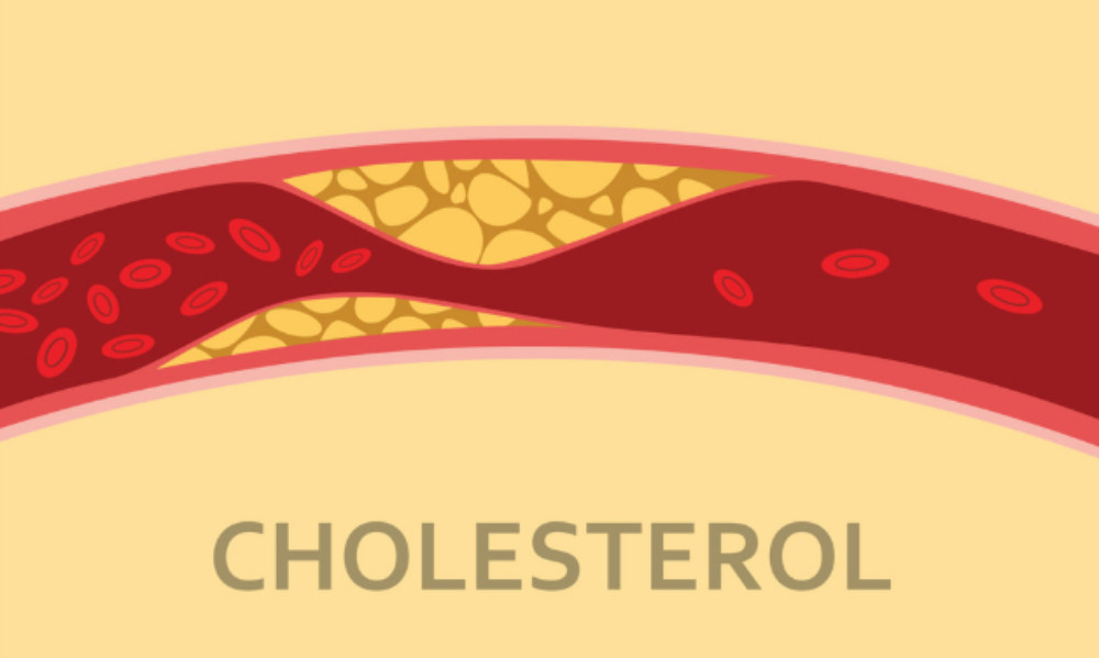 Nước gạo lứt đậu đen giúp kiểm soát lượng cholesterol trong máu