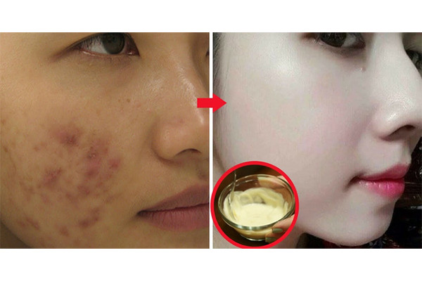 Quảng cáo huyền thoại về kem trộn
