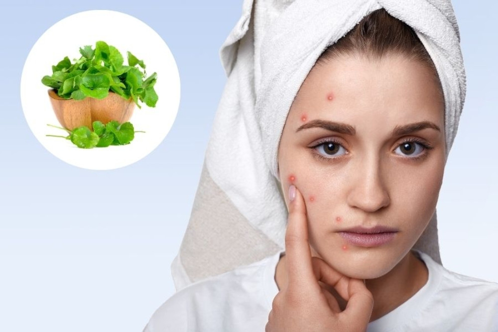 Khám Phá 10 Công Dụng Của Rau Má Trong Làm Đẹp